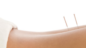 Read more about the article Acupuncture info – La Vie Acupuncture – Ventura and Canoga Park, CA