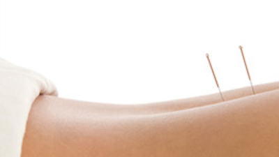 You are currently viewing Acupuncture info – La Vie Acupuncture – Ventura and Canoga Park, CA