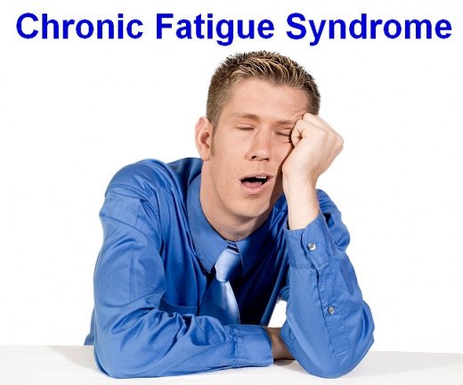You are currently viewing Can chronic fatigue syndrome be treated with acupuncture?