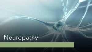 Read more about the article Breast Cancer and Neuropathy