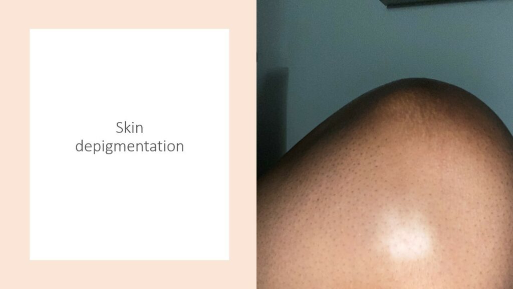 Acupuncture Acupuncture Los Angeles, Acupuncture Ventura, Canoga Park